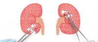An image of two kidneys made out of puzzle pieces